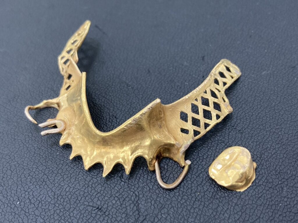 【買取実績】金歯✨🦷✨買取大吉　川崎南加瀬店　【神奈川県】
