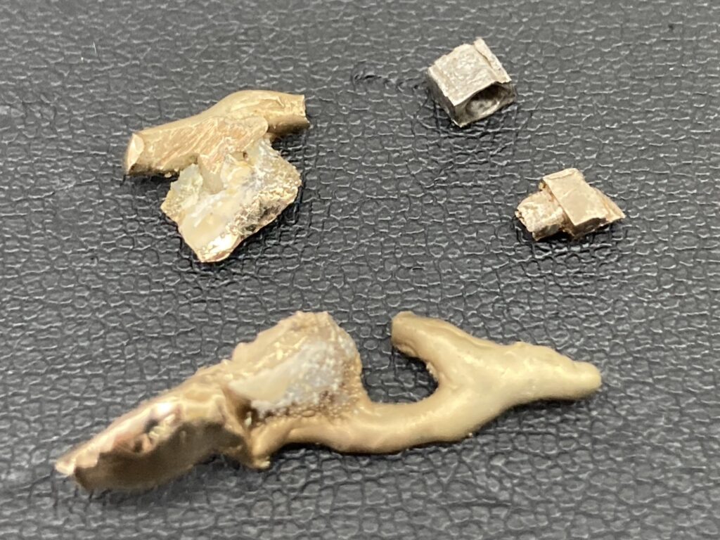 【買取実績】金歯と銀歯✨🦷✨買取大吉　川崎南加瀬店　【神奈川県】